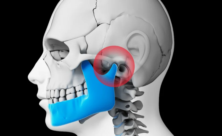 TMD and TMJ pain